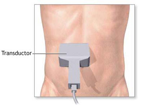 Urología Salamanca Ecografía