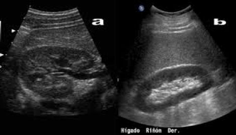 Urología Salamanca Ecografía