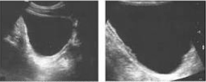 Urología Salamanca Ecografía
