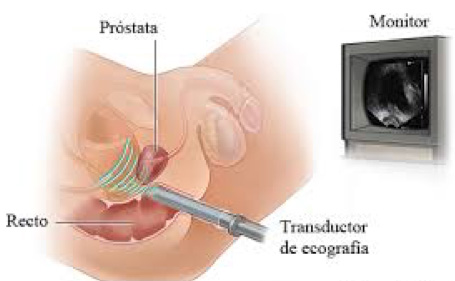 Urología Salamanca Ecografía