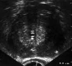 Urología Salamanca Ecografía