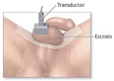 Urología Salamanca Ecografía
