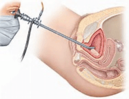 Clínica Urológica. Urología Salamanca. Dr. Miguel Ángel García